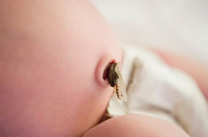 Body of newborn with Umbilical cord found floating Body of newborn with Umbilical cord found floating
