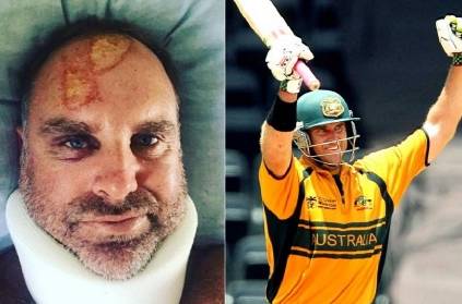 Matthew Hayden admits he\'s lucky to have survived after head injuries