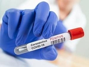 Famous actor tests positive for Coronavirus; fans worried